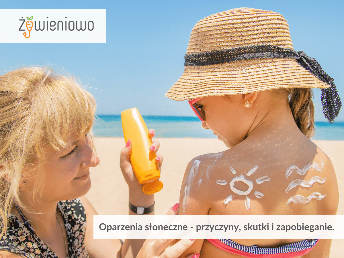 Oparzenia słoneczne.